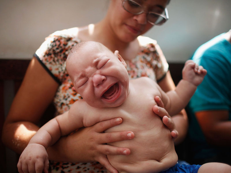 Baby-zu-kleiner-Kopf-wegen-Zika-Virus